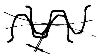 �F�X݆�͜�(zh��n)�p�����X݆�g(sh��)�Z(y��)�����ߴ煢��(sh��)